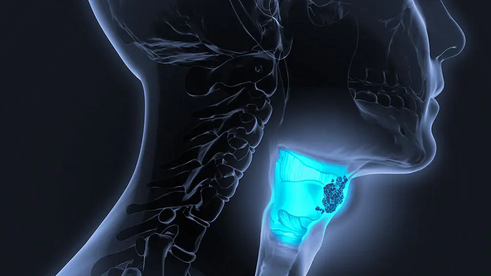 HPV+ / HPV- 2nd Line Head & Neck Cancer