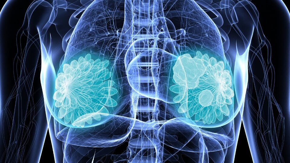 Body_Therapy_Page_Breast_Cancer