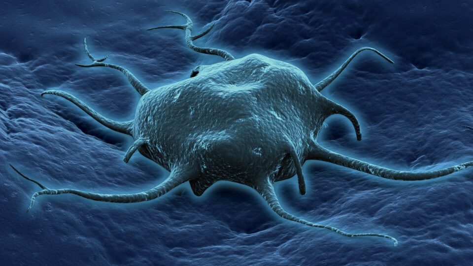 Body_Therapy_Page_Merkel_Cell_Carcinoma